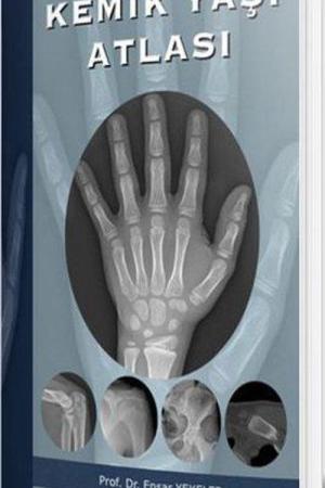 Kemik Yaşı Atlası