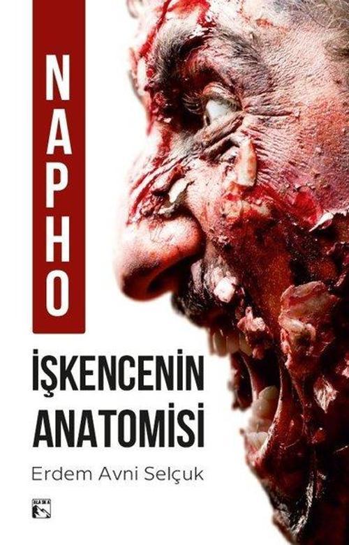 Napho İşkencenin Anatomisi