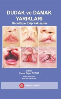 Dudak ve Damak Yarıkları